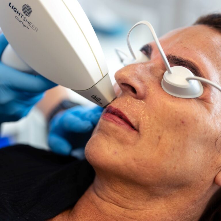 Lasertherapie gezicht Huidkliniek COSMED
